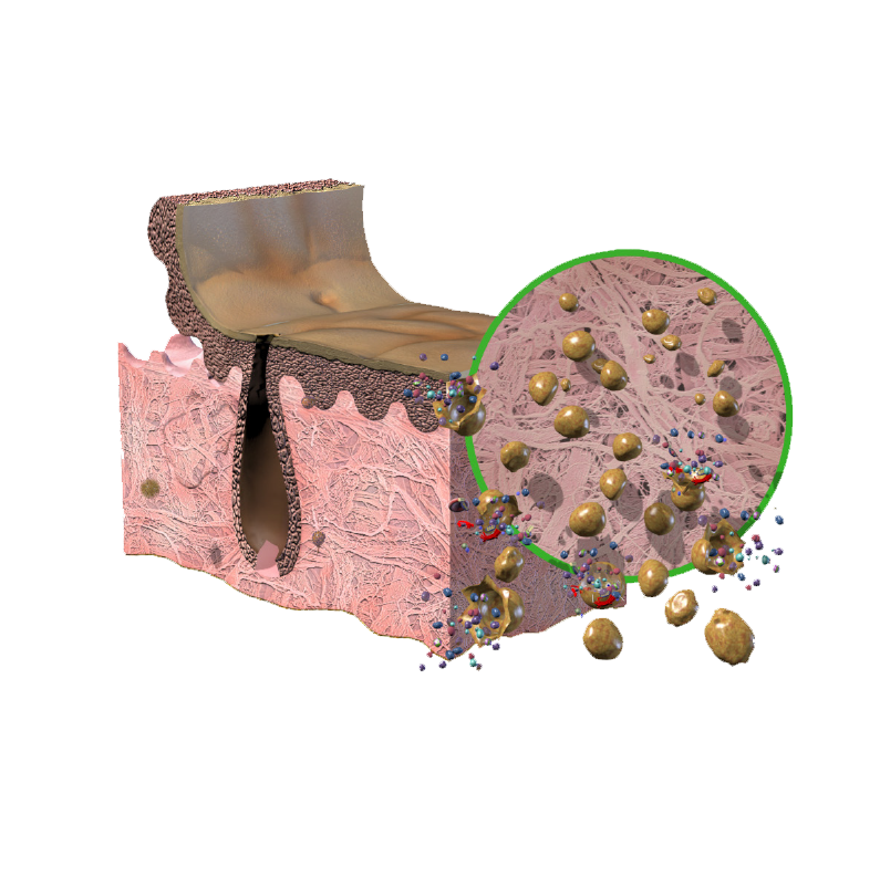 The Proprietary Tutoplast® Process - Step 2: Osmotic Treatment