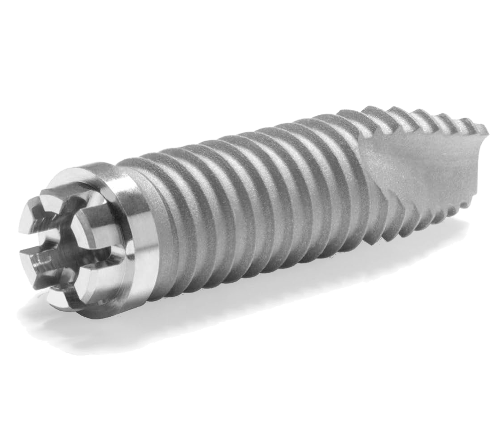 Close-up image of the ZimVie Spline Twist Dental Implant, showcasing its precision-engineered design with interdigitating projections and self-tapping spiral flutes that reduce surgical time, enhance stability, and facilitate bone chip removal. This implant also supports the Snap Delivery System for convenient and sterile placement, and offers surface options including MTX™ Microtextured Surface and MP-1® HA Coating.