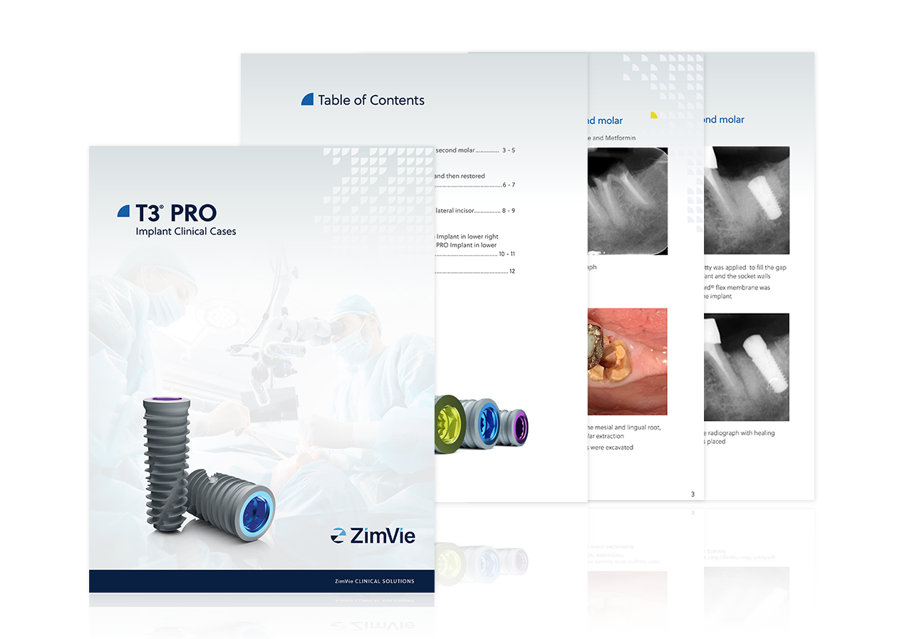ZimVie T3® PRO Implant Clinical Cases Brochure