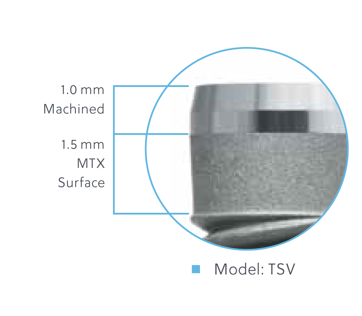 TSV Implant Configurations available on select implants Model: TSV