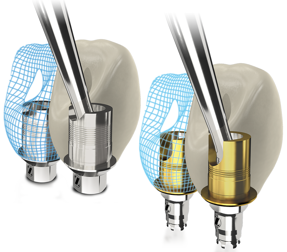 Flex & Express Abutments