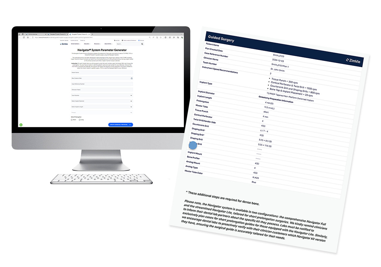 An image showing the ZimVie Navigator System Parameter Generator, a digital tool used to create a detailed surgical protocol. The graphic displays a user interface on a computer screen and a corresponding printed document, highlighting its function in generating precise parameters and a step-by-step guide for guided dental implant surgery.