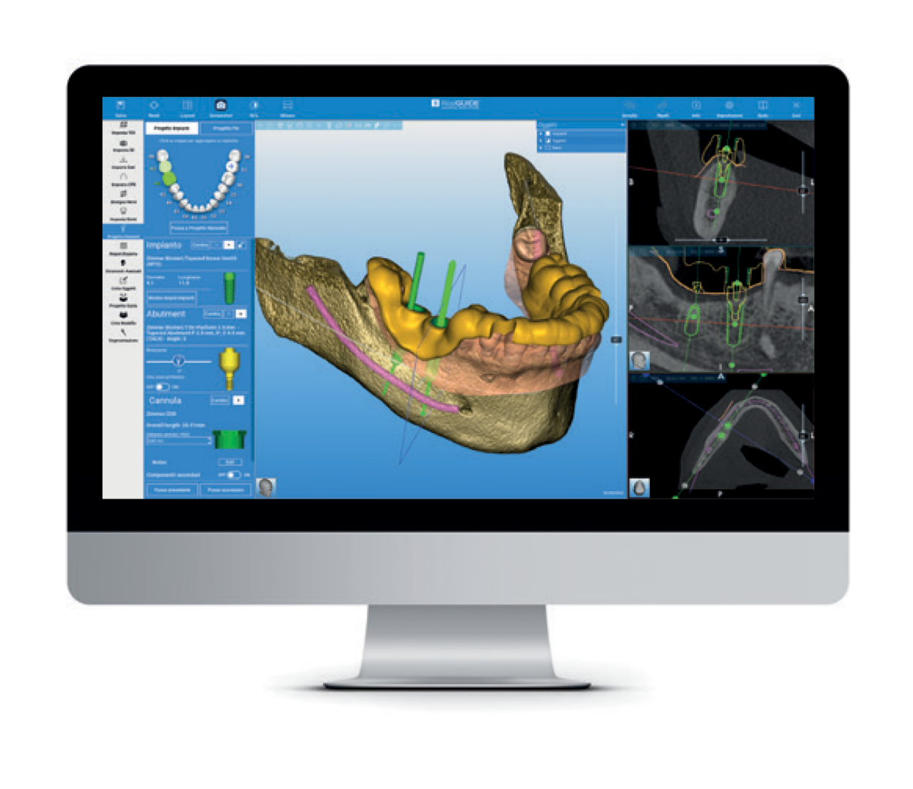 RealGUIDE Software Suite for Digital Dental Implant Planning RealGUIDE Software Suite